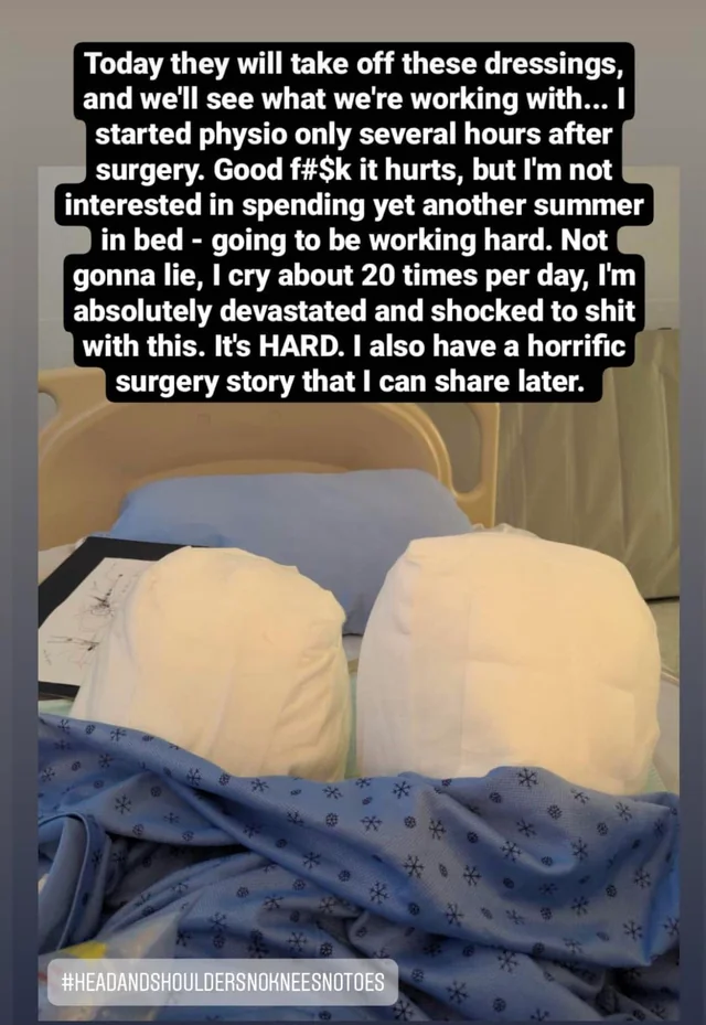 Kelly Ronahan underwent Leg amputation